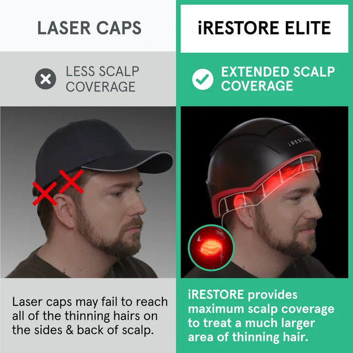 iRestore Elite Apex Panel + Hair Helmet Bundle